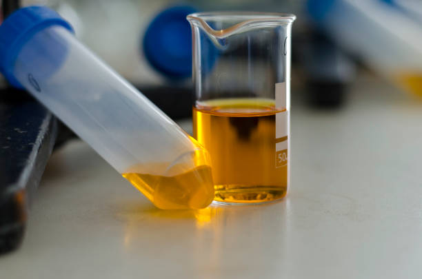 istock Urine sample-series of tubes with yellow coloring gradient 816461302