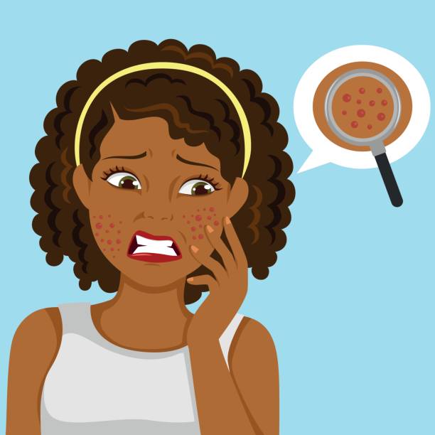 black girl with pimples vector art illustration
