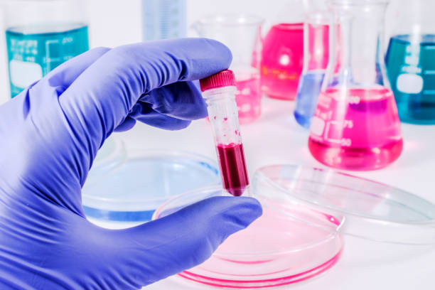 istock Scientist with blood sample. Medical laboratory. 817873226