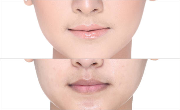 istock Before After, using Lipstick on moutth lip by gloss and sharpen by brush 819595828