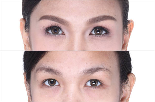istock Before After, make up cosmetology on eye, eyeshadow, eyebrowns 819595860