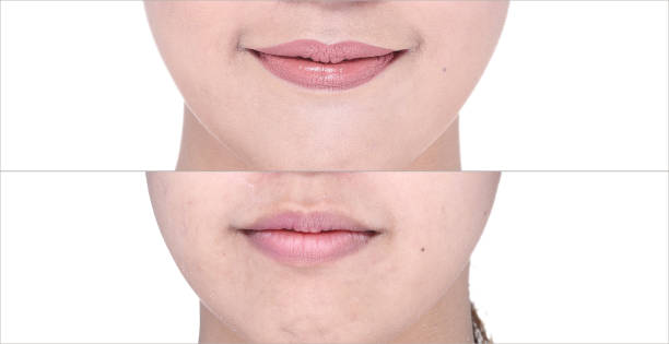 istock Before After, using Lipstick on moutth lip by gloss and sharpen by brush 819595884