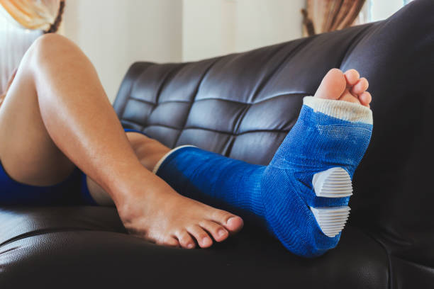 istock broken leg in a plaster cast with soft-focus in the background. over light 819763154