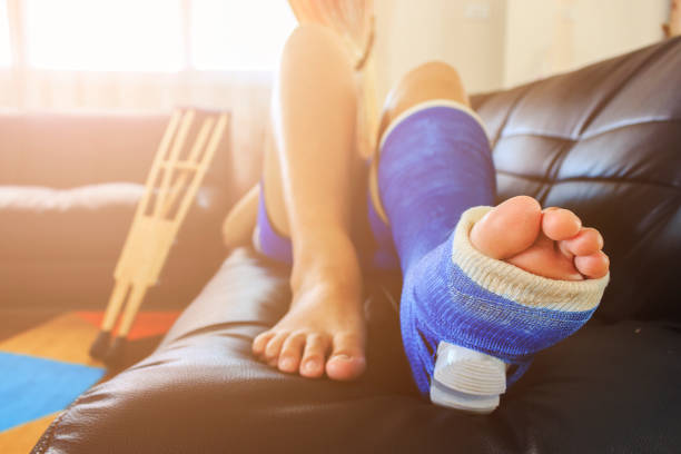 broken leg in a plaster cast with soft-focus in the background. over light broken leg in a plaster cast with soft-focus in the background. over light ankle stock pictures, royalty-free photos & images