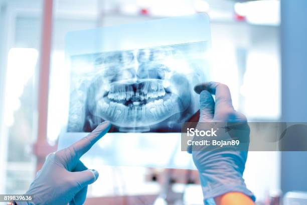 Xray Image Stock Photo - Download Image Now - X-ray Image, Dental Health, Dentist