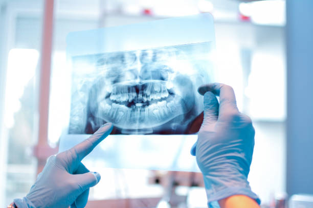 imagem de raio-x. - equipamento dentário - fotografias e filmes do acervo