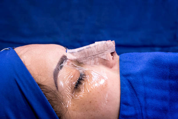 primo dell'immagine del profilo del naso della paziente femmina dopo la deviazione del setto nasale e la chirurgia della rinoplastica. - nose job foto e immagini stock