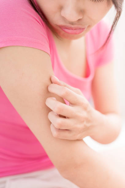 istock woman with itchy skin 820356240