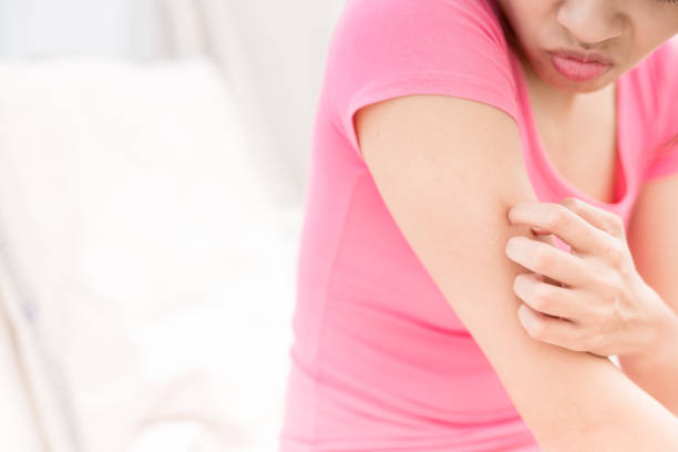 istock woman with itchy skin 820356494