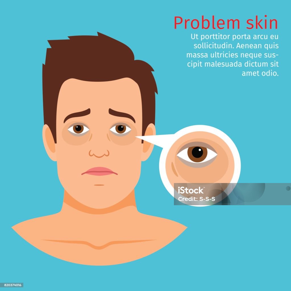 Face Problem Sign Young Man Face Problem Black Circles Stock Illustration - Download ...