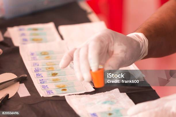 Hand Of Doctor Smear Stool Exam Stock Photo - Download Image Now - Epidemiology, Joseph Papp Public Theater, Analyzing