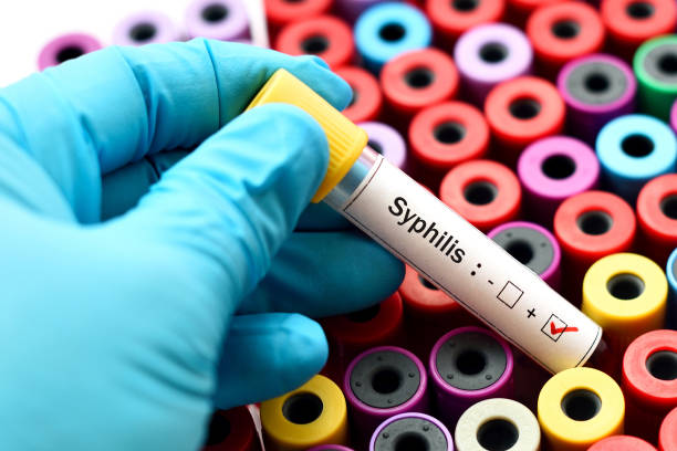 syphilis positive - sexually transmitted disease stock-fotos und bilder