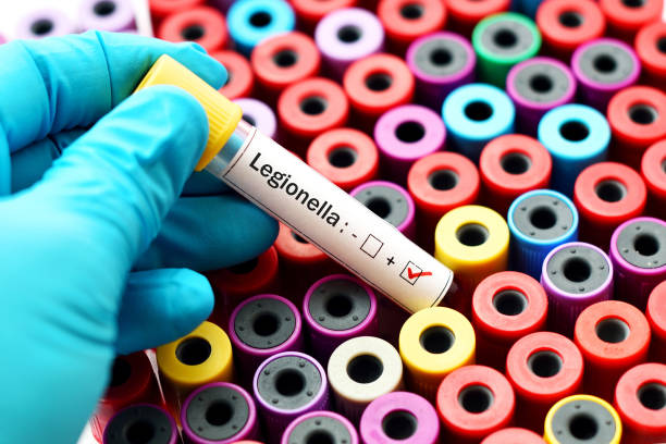 Legionella positive stock photo