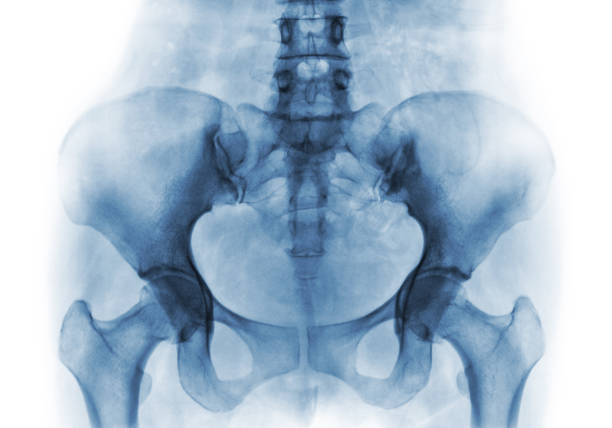 radiografía de película de pelvis humana normal y articulaciones de la cadera - haunch fotografías e imágenes de stock