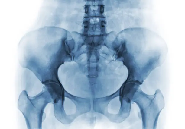 Film x-ray of normal human pelvis and hip joints .