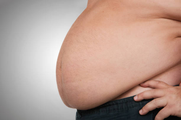 Obesity Obesity, close up of fat mans belly, isolated on gray background with copy space pot belly stock pictures, royalty-free photos & images