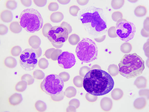 white blood cells - morphology imagens e fotografias de stock
