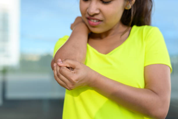 istock Young woman holding painful elbow 821437088