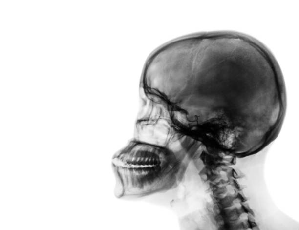 istock X-ray normal skull and cervical spine . Lateral view . 821457418