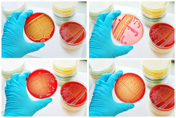 バクテリアの文化 - blood agar ストックフォトと画像