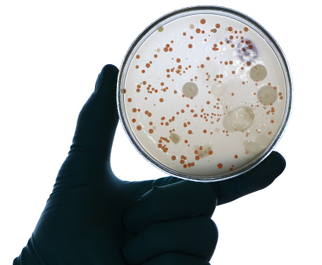 Scientist's hand in white lab coat and blue glove holding an opened Petri dish (plate) covered by bacterial colonies. Backlight.