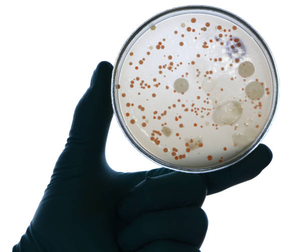 mão enluvada detém um prato perti retro-iluminado - bacterium staphylococcus colony epidemic - fotografias e filmes do acervo