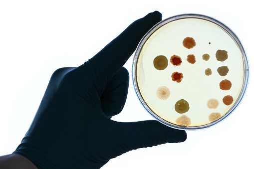 Scientist's hand in white lab coat and blue glove holding an opened Petri dish (plate) covered by bacterial colonies. Sarcina lutea,  Staphylococcus aureus  and other bacterial colonies.  Backlight.
