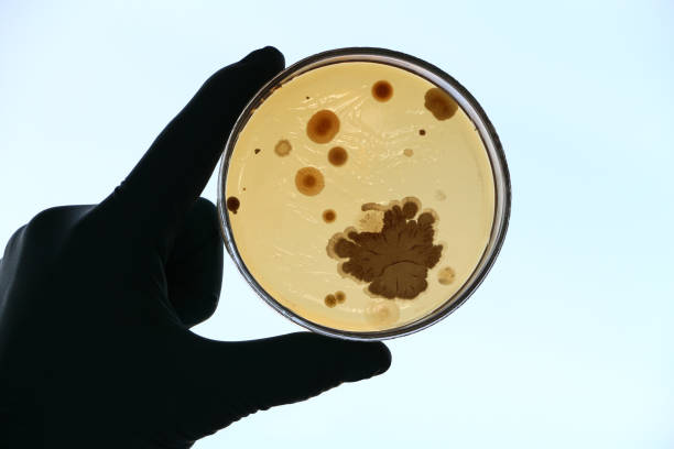 hand holds  an agar petri plate on sky background - petri dish agar jelly laboratory glassware bacterium imagens e fotografias de stock