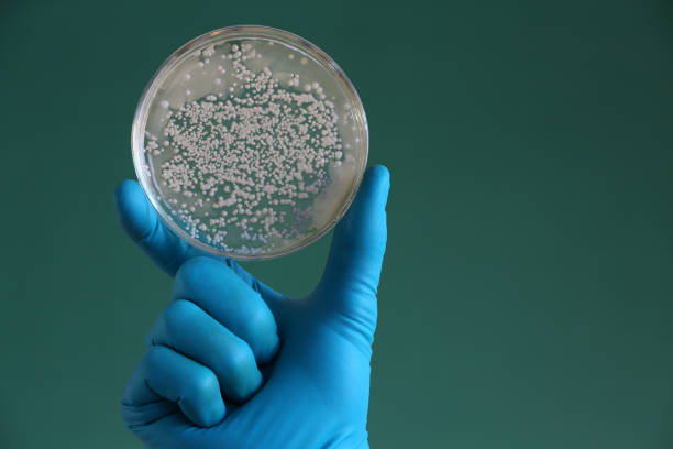 hand in glove  is  holding an agar petri plate - petri dish agar jelly bacterium science imagens e fotografias de stock