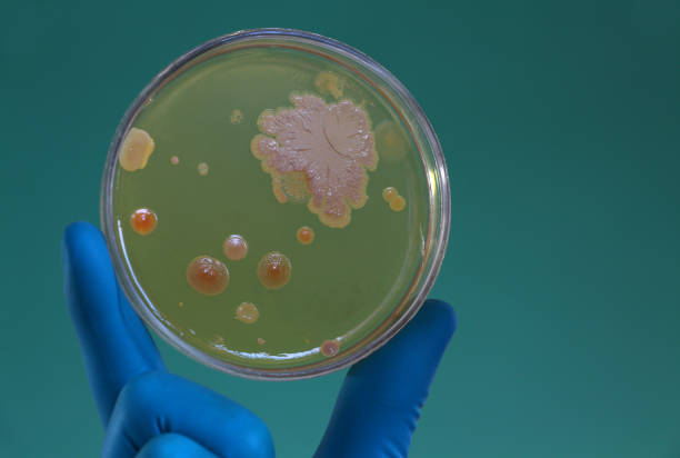 istock Scientist  holding an agar Petri dish covered with bacterial colonies 821648118