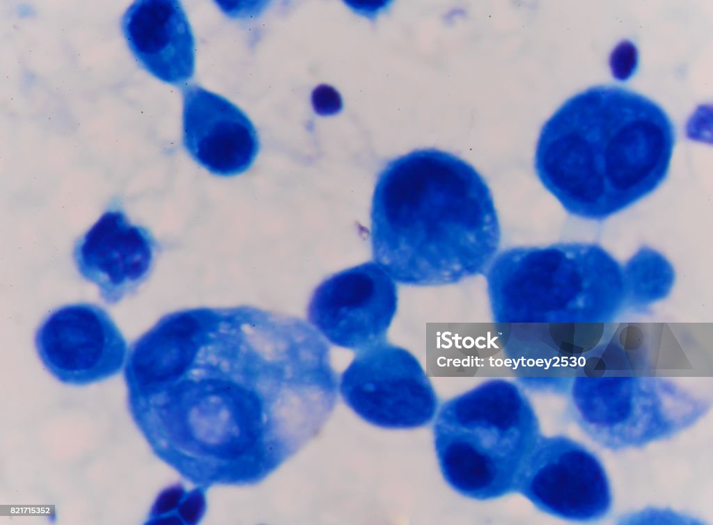 Blue Cell. Figure Blue Cell With Blue Stain Medical Science Background Concept Stock ...