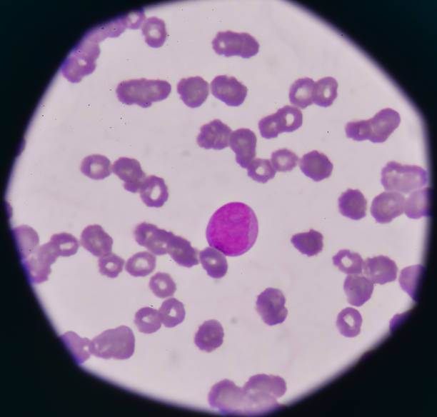 istock White blood cells Blast cell on red blood cells background. 821715428