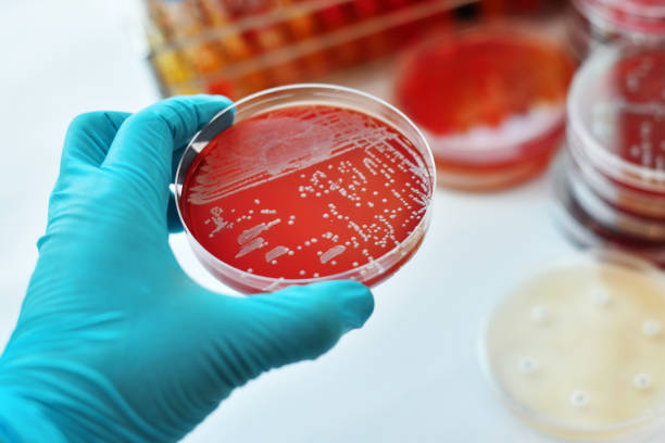 박테리아 문화 - staphylococcus aureus 뉴스 사진 이미지