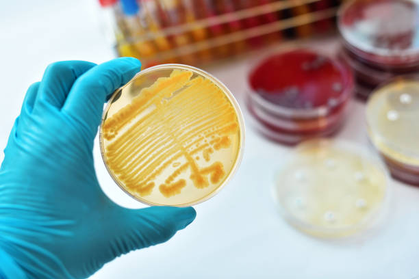 黄色のコロニー - agar jelly medical sample bacterium microbiology ストックフォトと画像