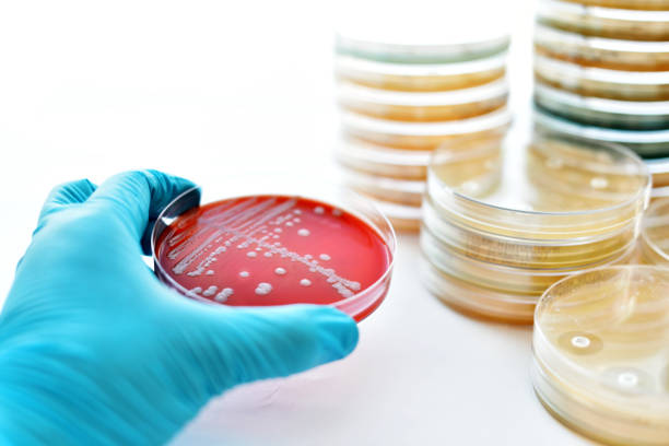 バクテリアの文化 - agar jelly medical sample bacterium microbiology ストックフォトと画像