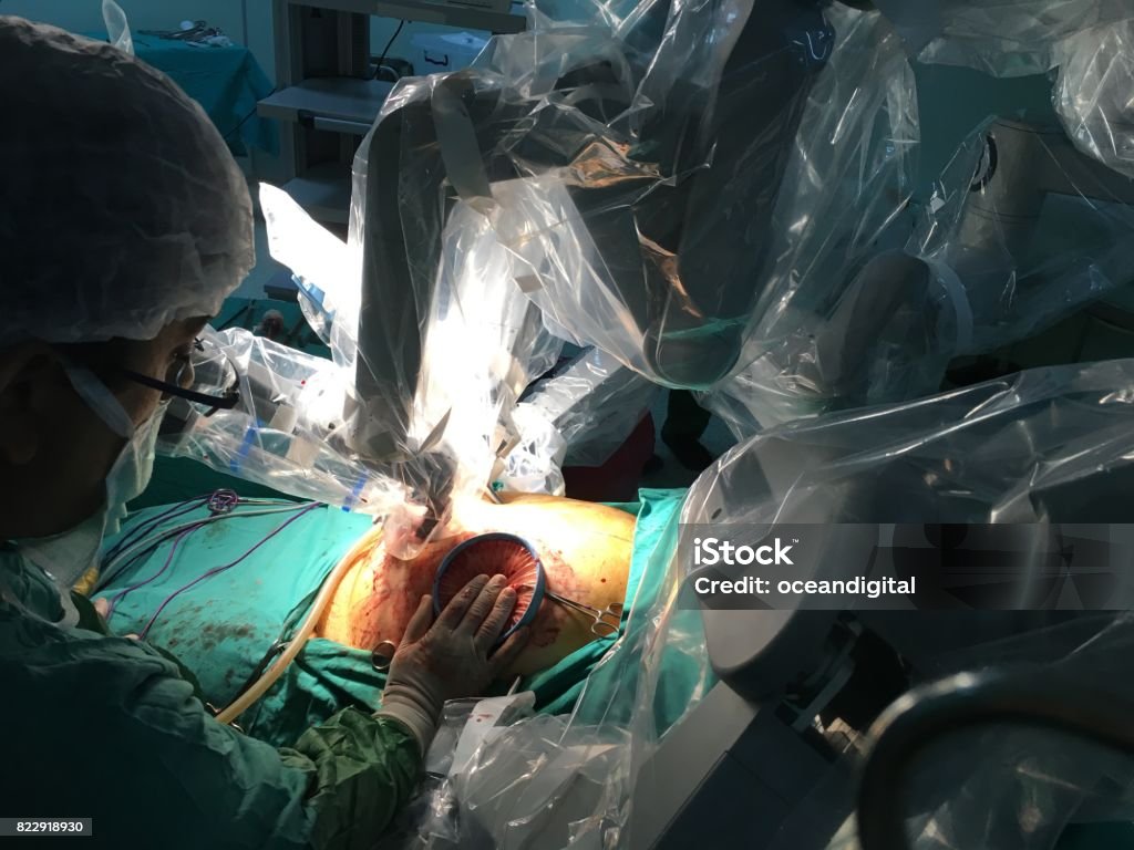 Robotic surgery. Robotic surgery in operation room. Robotic Surgery Stock Photo