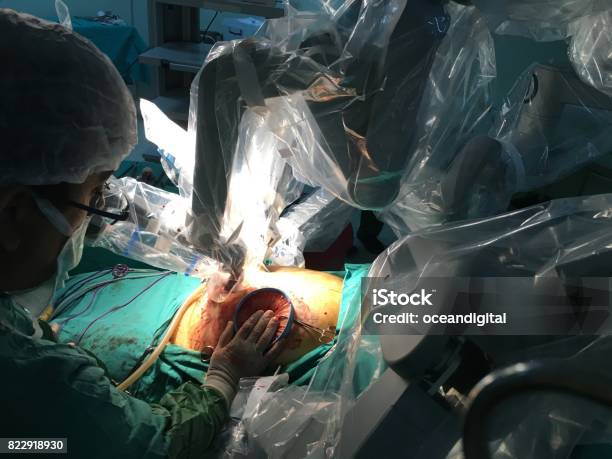 Robotic Surgery Stock Photo - Download Image Now - Robotic Surgery, Robot, Surgery