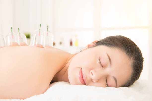 женщина, лежащая на кровати в спа-салоне - acupuncture cupping стоковые фото и изображения