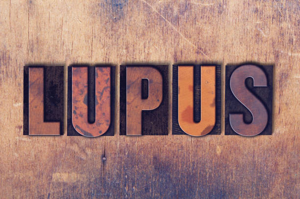 istock Lupus  Theme Letterpress Word on Wood Background 824327862