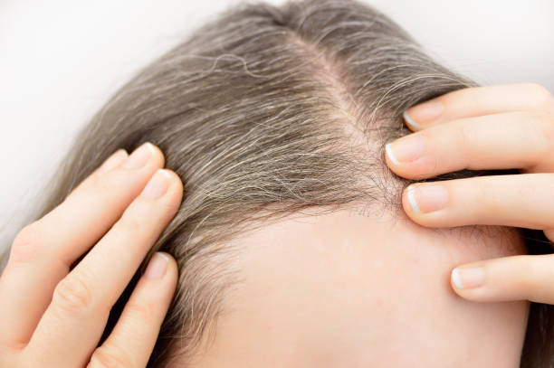 istock Young woman shows her gray hair 824626852