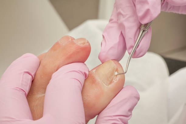 konzept-körperpflege. - podiatry chiropody toenail human foot stock-fotos und bilder