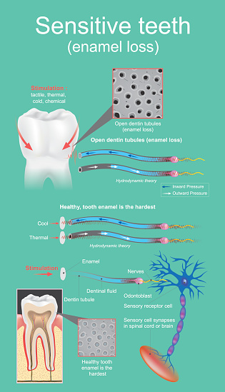 Sensitive dental is defined as intense and transitory pain that is cause by the exposure of the dentin. Vector graphic design.