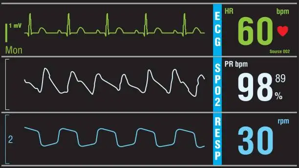 Vector illustration of Patient display medical exam vital signs