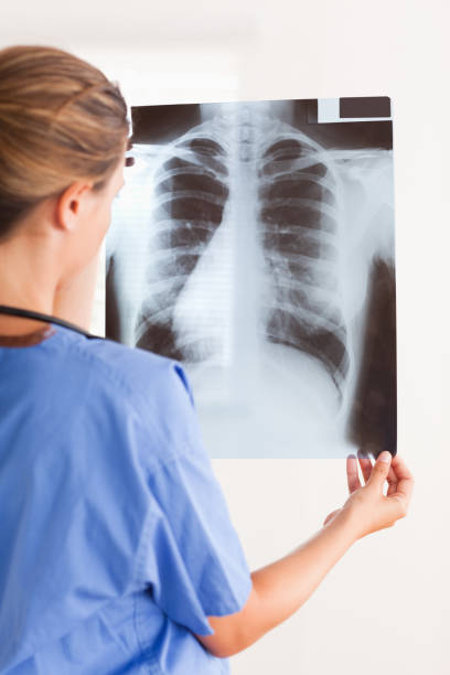 istock Doctor holding a xray having a stethoscope around her neck 824960212