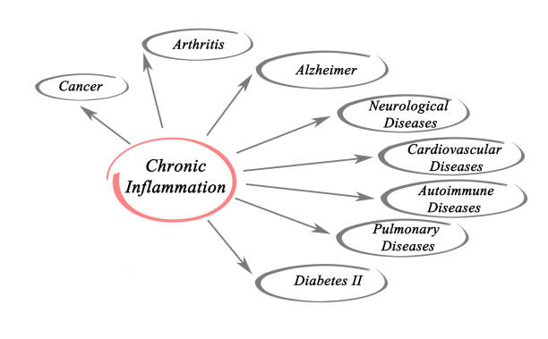 Chronic Inflammation stock photo