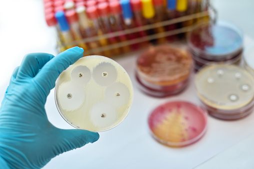 Antimicrobial susceptibility testing in petri dish