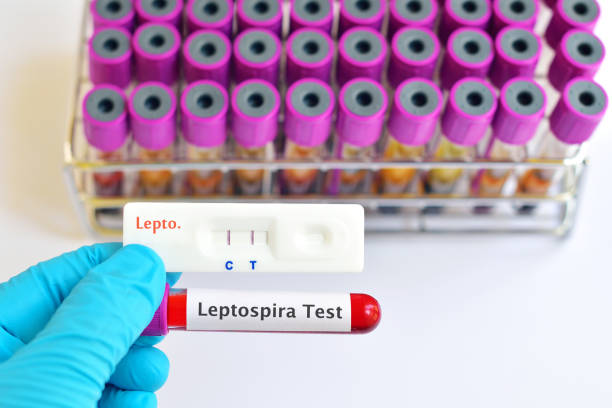 Leptospirosis positive Blood sample positive with Leptospirosis by test kit leptospira stock pictures, royalty-free photos & images