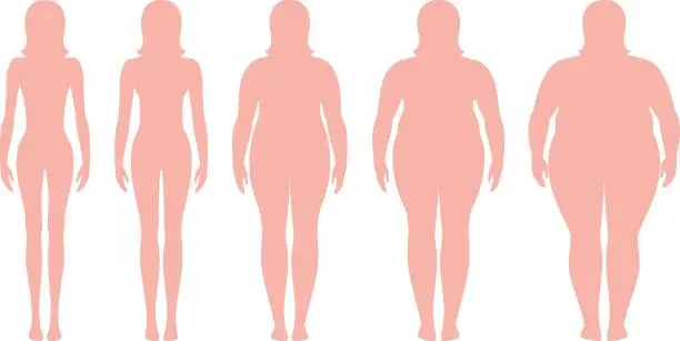 Vector illustration of Body mass index vector illustration from underweight to extremely obese. Woman silhouettes with different obesity degrees.