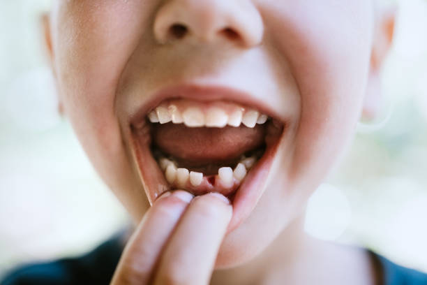 Child with First Lost Tooth A boy holds his mouth open to show one of his front baby teeth is missing. A milestone in child growth and development. baby teeth stock pictures, royalty-free photos & images