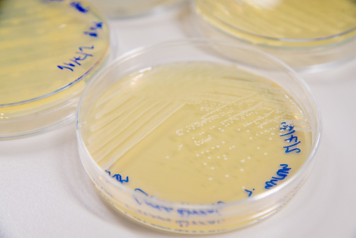 Close-up detail of multiple plates of petri dishes containing cultures of Methicillin-Resistant Staphylococcus Aureus (MRSA). Healthcare and infectious diseases concept.